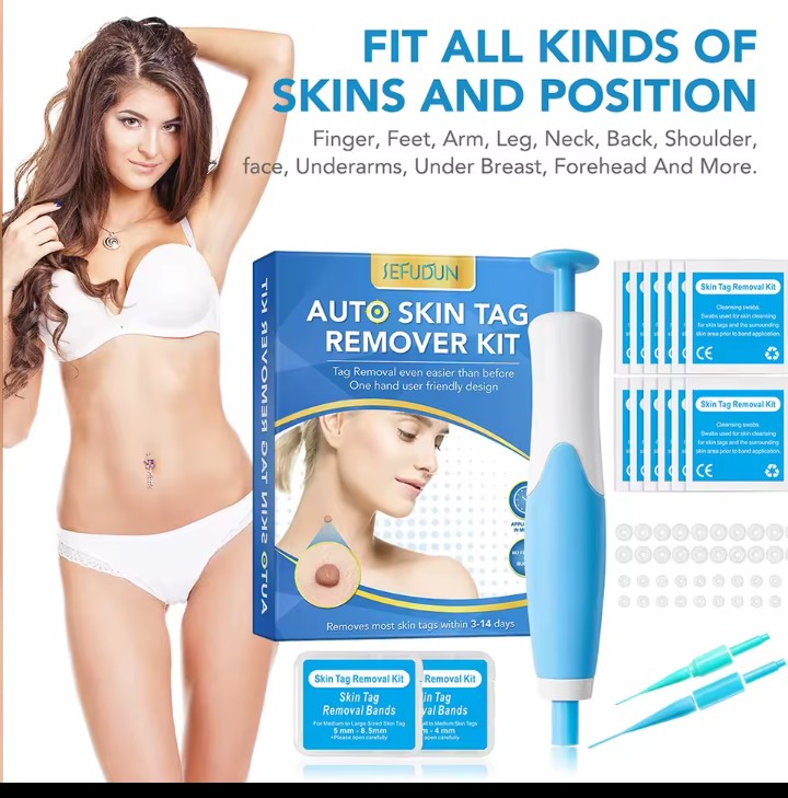 Rubber rings skin tag removal