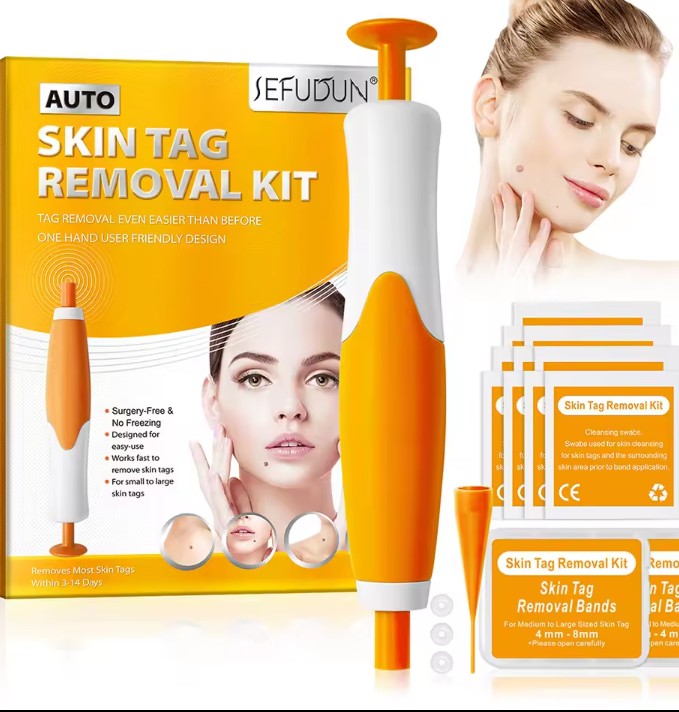 Rubber rings skin tag removal