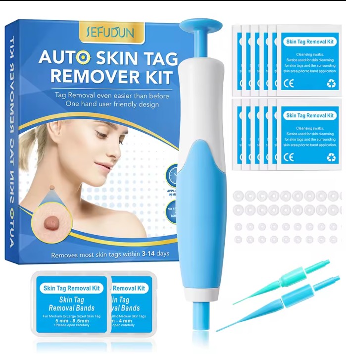 Rubber rings skin tag removal